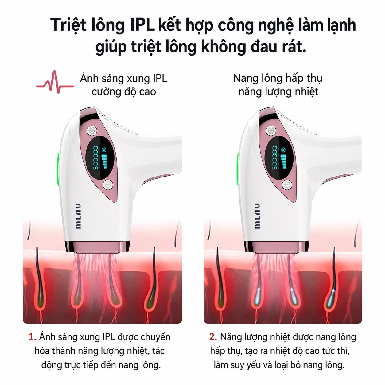 Cơ chế ánh sáng IPL của MLay T4